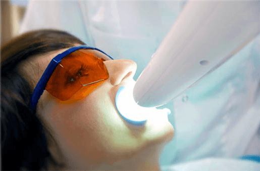 Understanding the Causes of Teeth Sensitivity St albans