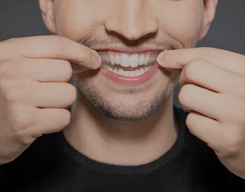 How Are Invisible Aligners Changing Orthodontic Treatments St albans?