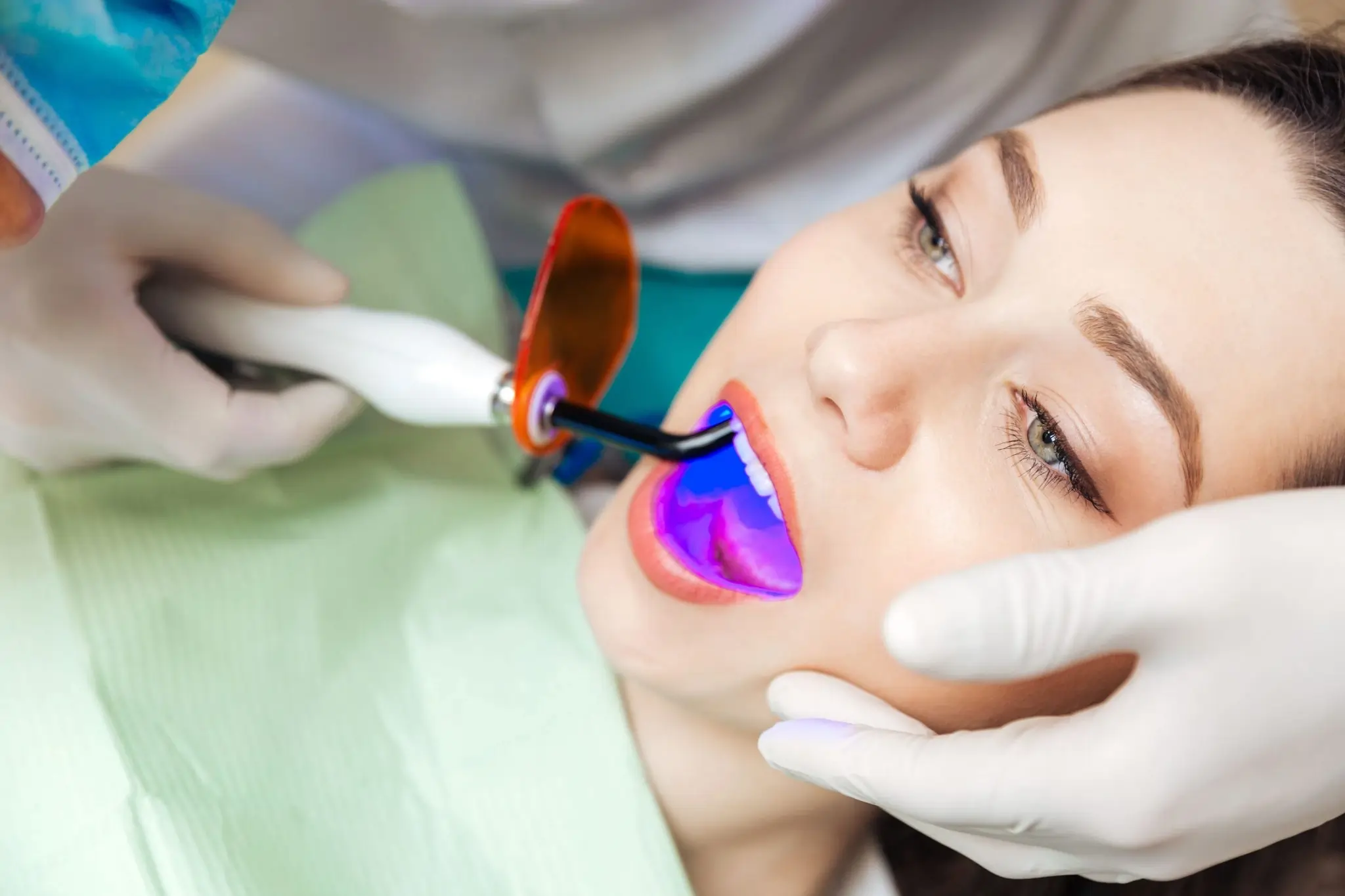 Common Risks of Whitening Without Expert Dental Guidance St albans