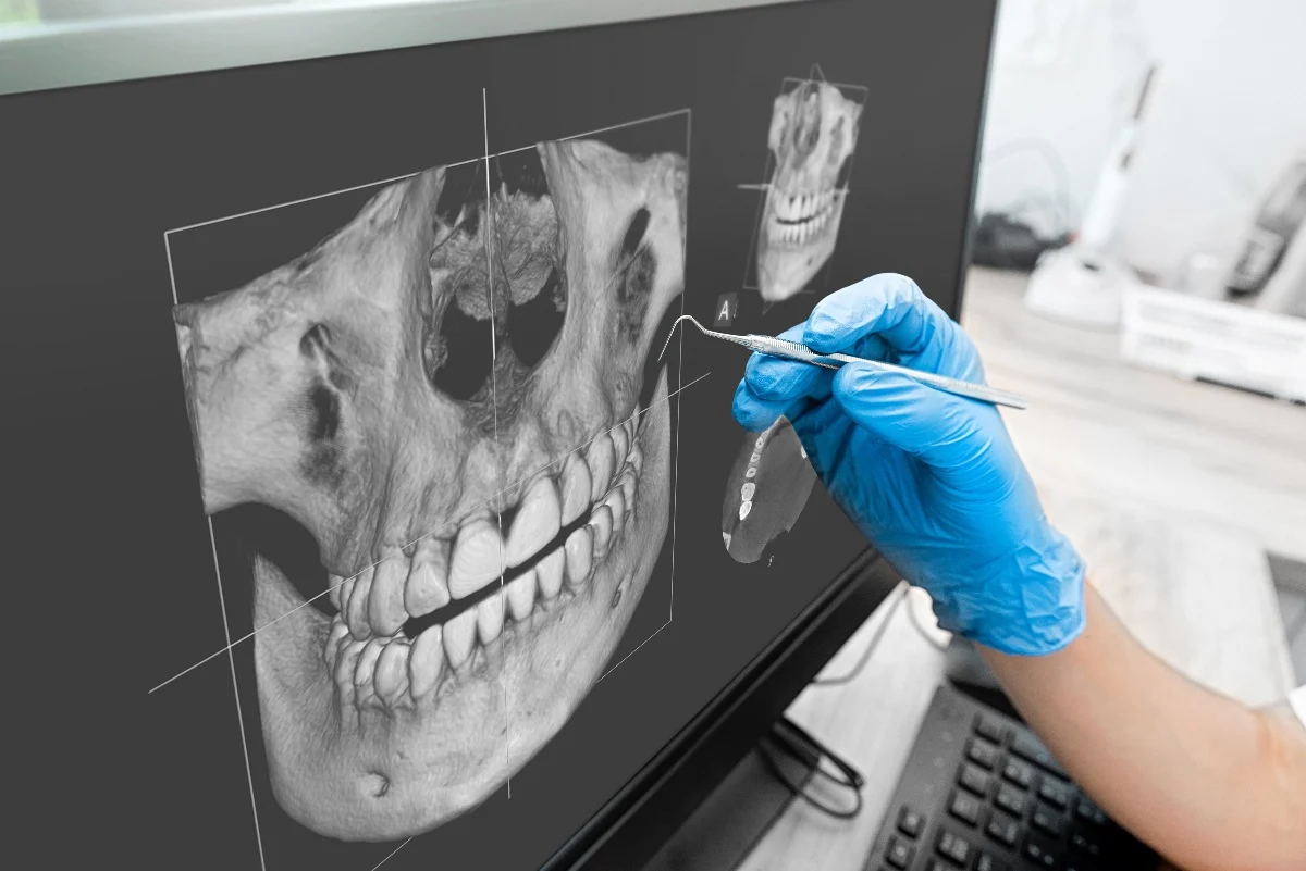 Key Benefits of 3D Printing for Patients and Dentists St albans