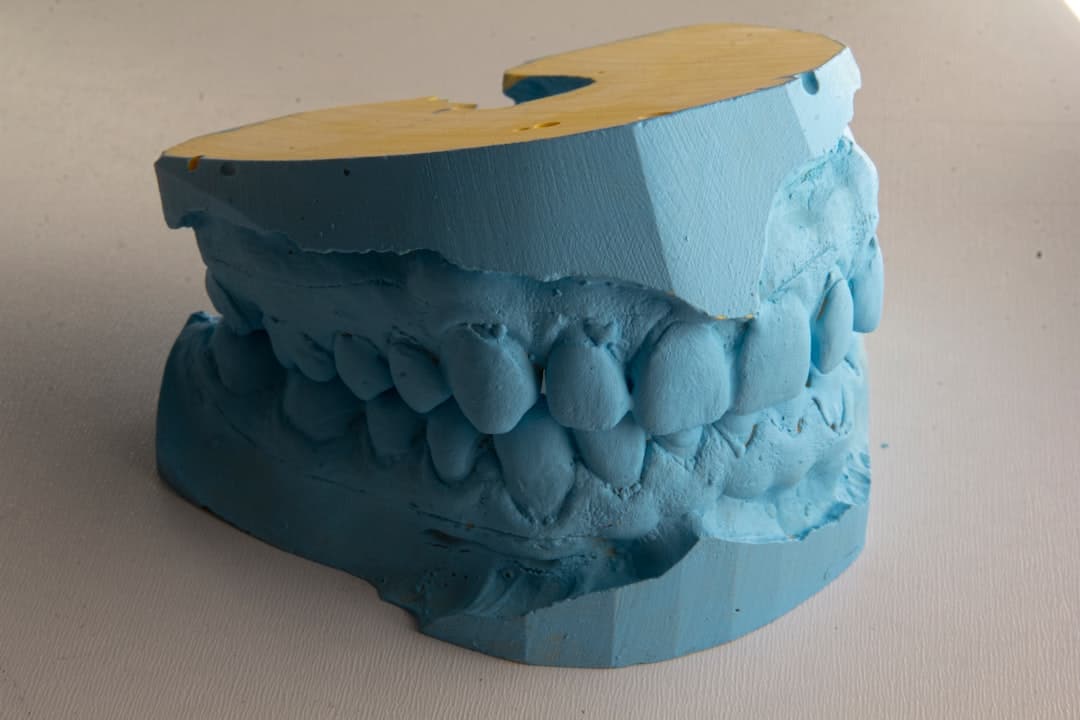 How Do Dental Implants Improve Jawbone Health and Oral Function St albans?