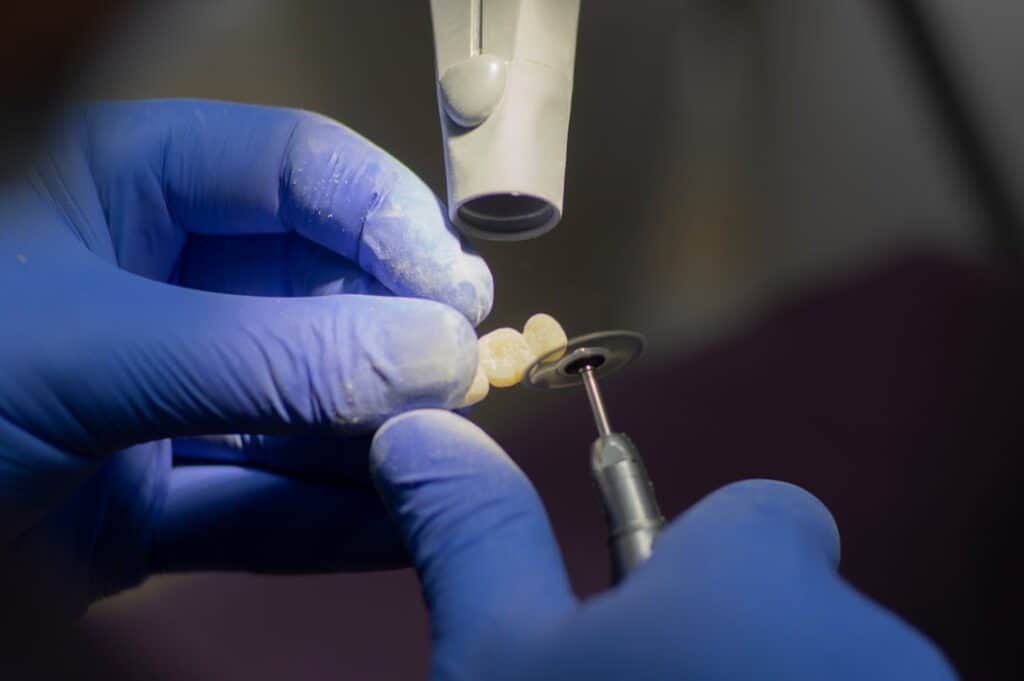 Customised Dental Solutions: Crowns, Aligners, and Implants St albans