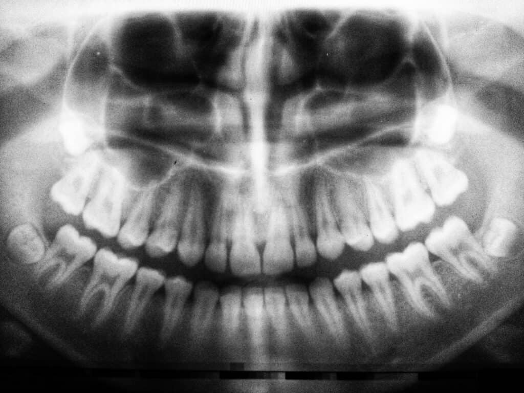 The Future of 3D Printing in Oral Healthcare St albans